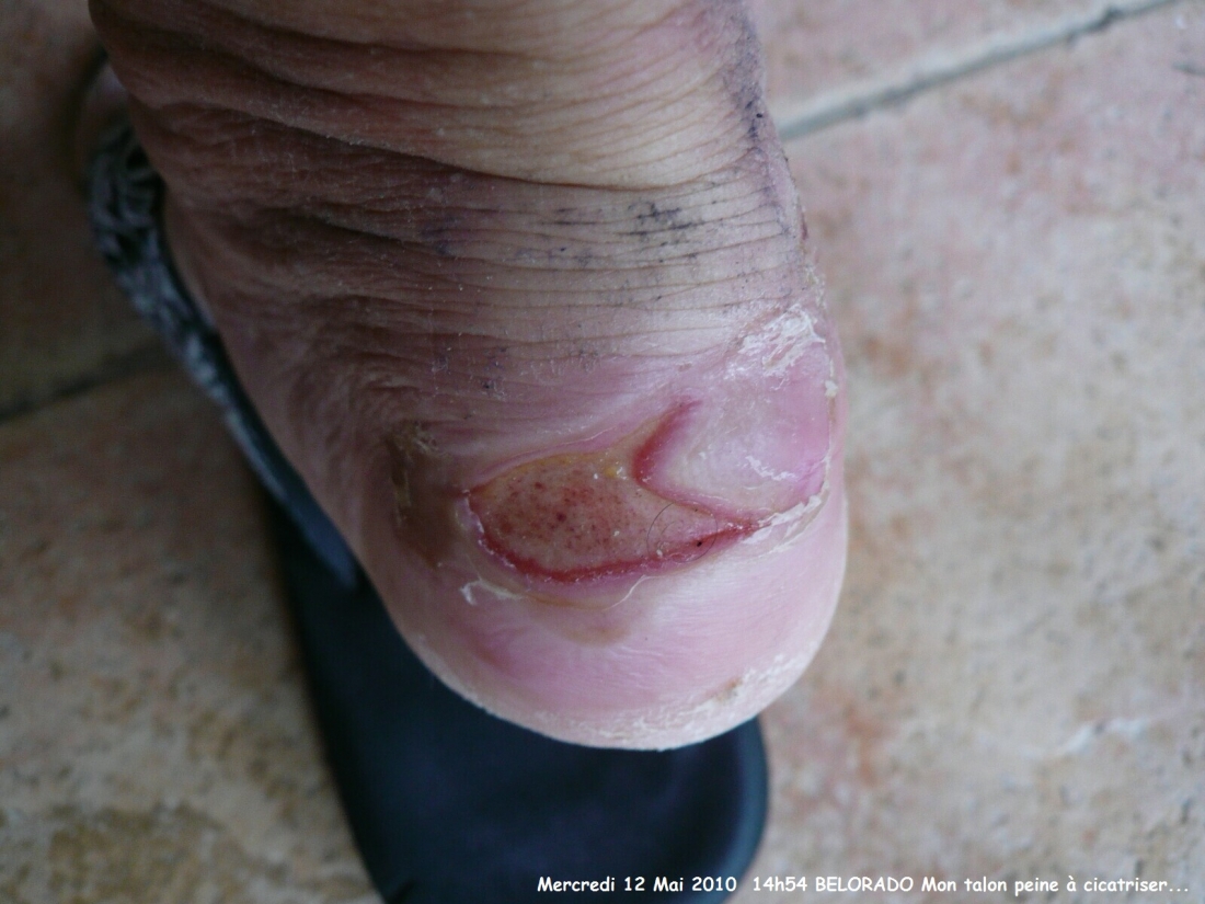 2010.0512.1454.14.Etape 10