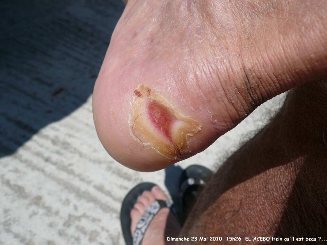 2010.0523.1526.44.Etape 21