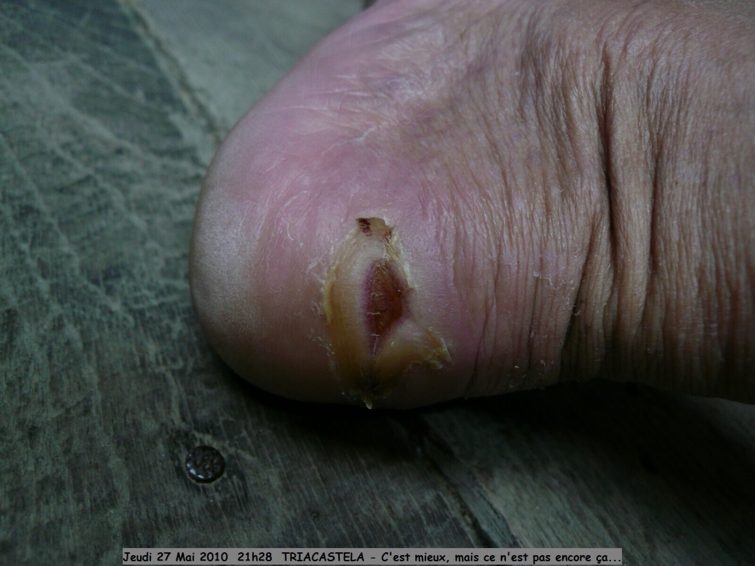 2010.0527.2128.15.Etape 25