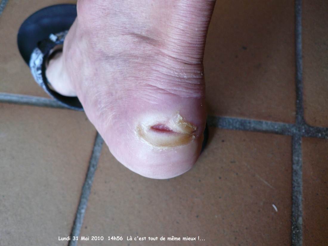 2010.0531.1456.53.Etape 29