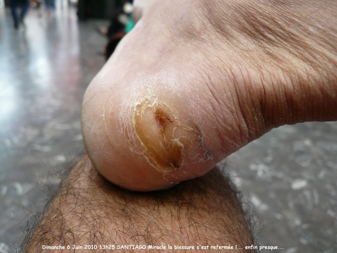 2010.0606.1325.39.Etape 35